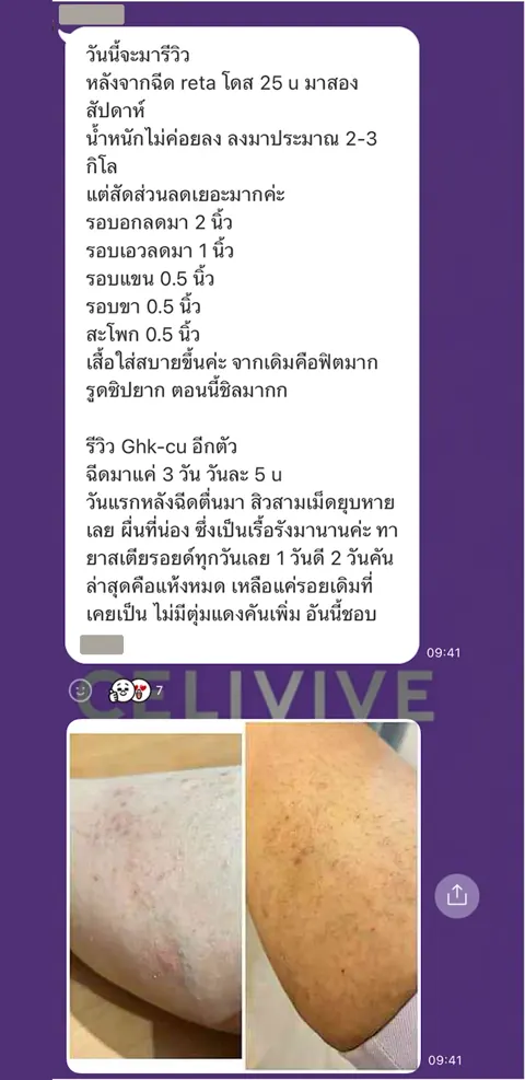 ภาพรีวิวการดูแลน้ำหนัก ลำดับ 105
