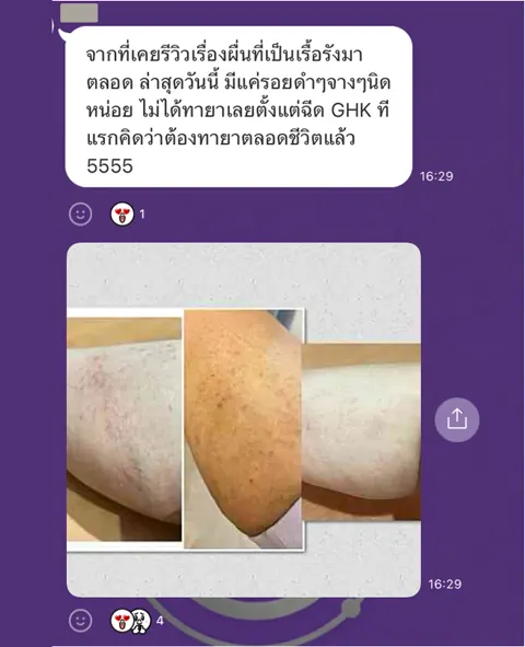 ภาพรีวิวงานผิว ลำดับ 195